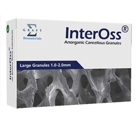 Губчатые гранулы для костной пластики InterOss, флакон, 1,0-2,0 мм, 0,5 г/2,0 куб. SGBIOLG050